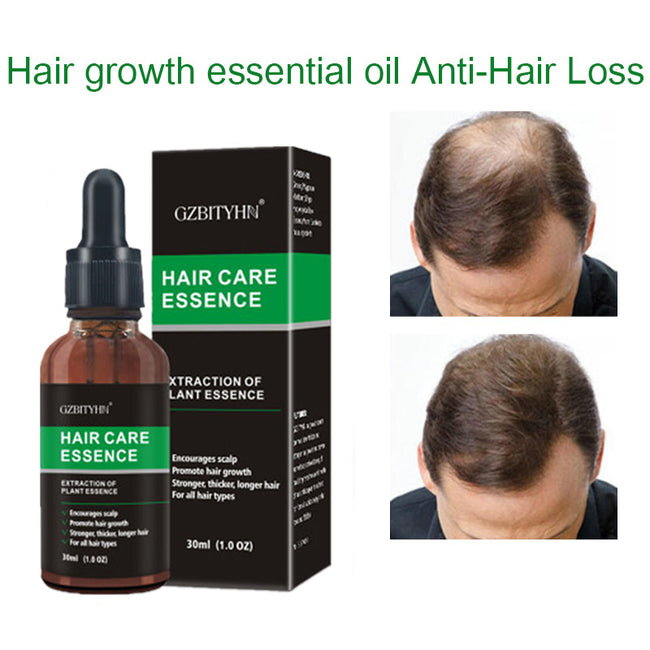 Hair Growth Oil Hair Growth Oil Oem Hair Care Essential Oil Hover Image