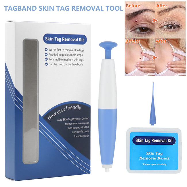 Skin Tag Removal Kit Home Use Mole Wart Remover Micro Band Skin Tag Treatment Tool Easy To Clean Skin Care Tool Hover Image