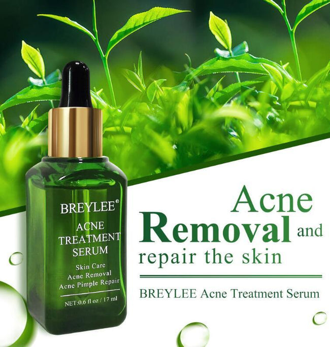Acne Treatment Serum Facial Repair Oil Main Image