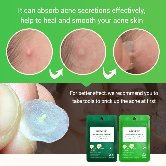 Tea Tree Acne Patch Fades Acne Marks and Ultra-thin Main Image