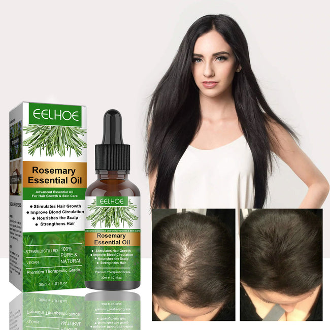 Rosemary Anti-Breakage Nourishing Hair Care Oil Hover Image