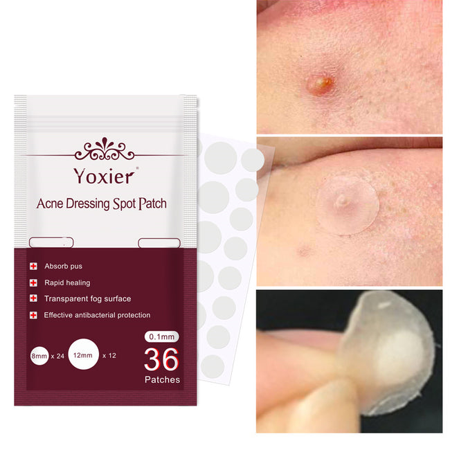 Skin Care Tools Acne Dressing Spot Patch Blemish Treatment Invisible Acne Stickers Pimple Remover Set Face Cream Main Image