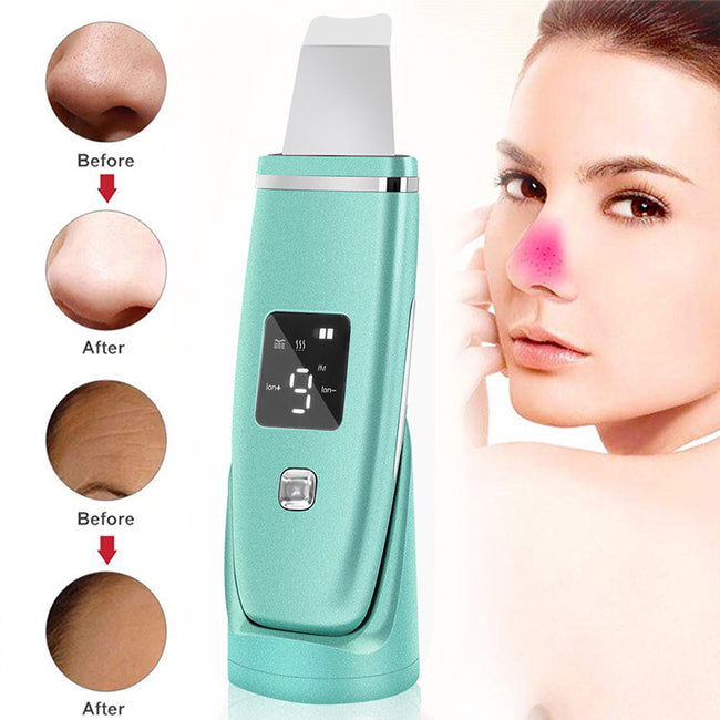 Ultrasonic Vibration Blackhead Remover Deep Cleansing Face Scrubber Pore Cleaner Lifting Machine Facial Led Peeling Shovel Hover Image