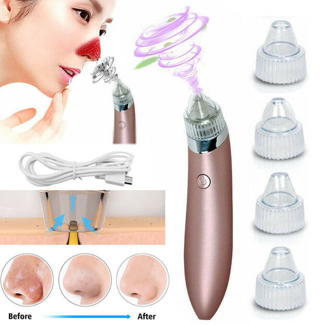 Electric Blackhead Vacuum Pore Cleaner Acne Pimple Remover Strong Suction Tool Electric Blackhead Remover Pore Vacuum Suction Diamond Dermabrasion Face Cleaner Hover Image