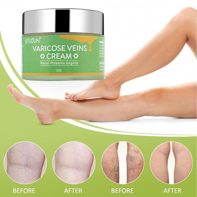 Vein Cream Red Blood Streaks Repair Earthworm Leg Bruises Bulge Relief Pain Safflower Skin care lotion Varicose Cream Hover Image